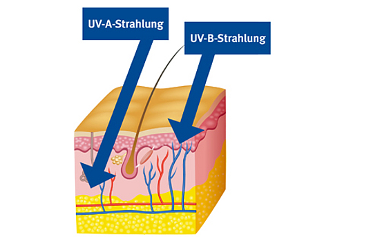 Grafik zu Risiken der UV-Strahlung