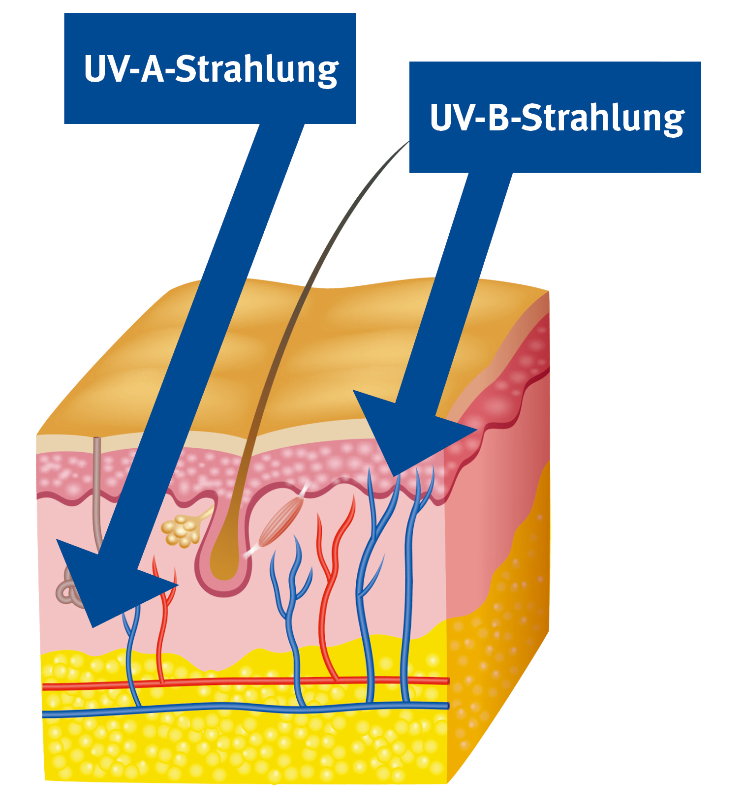 UV-Strahlung auf der Haut